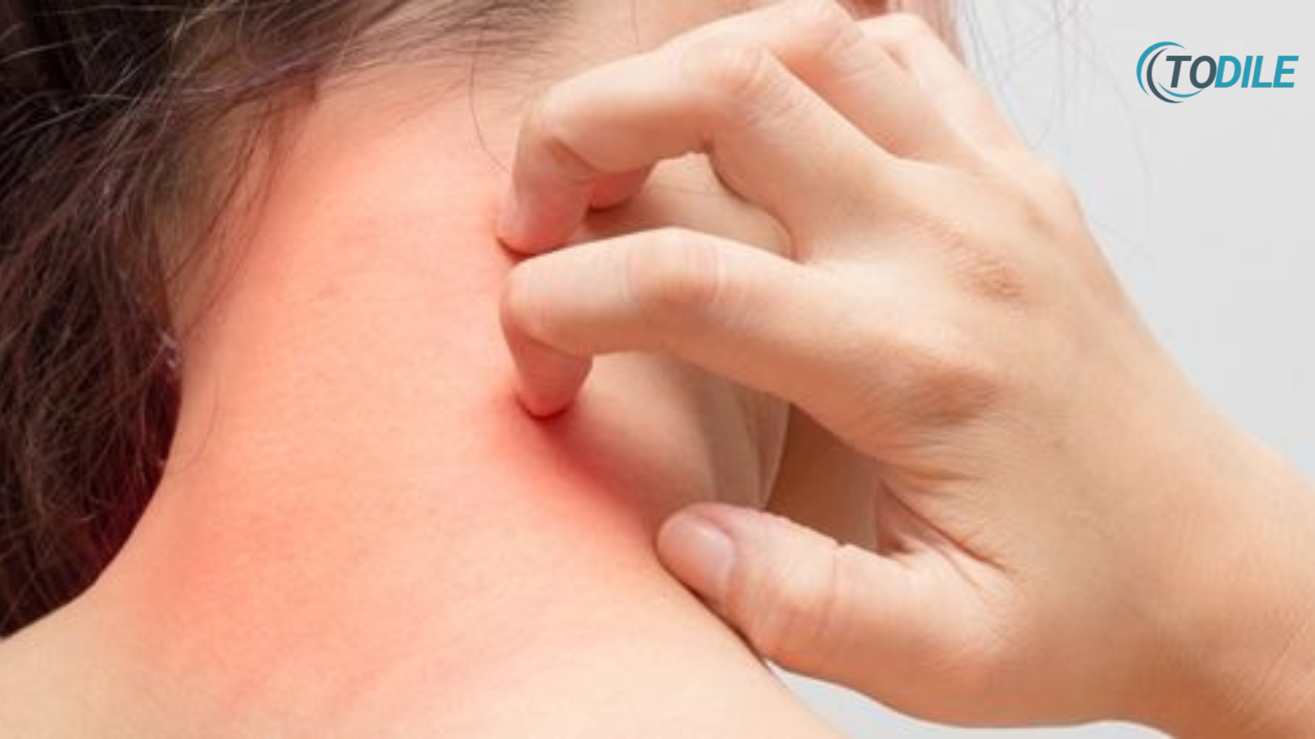 Read more about the article Signs That May Indicate Cancer: Pay Attention to Your Body