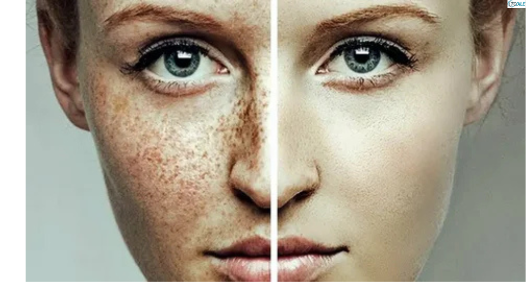 Read more about the article 11 Simple Ways to Get Rid of Sunspots