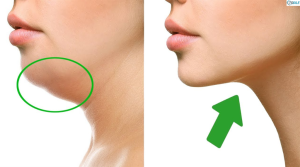 Read more about the article How to Get Rid of Neck Fat Easily