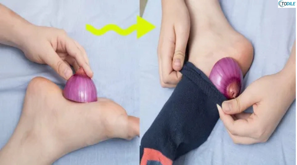 Read more about the article Why You Should Try Sleeping With an Onion in Your Sock