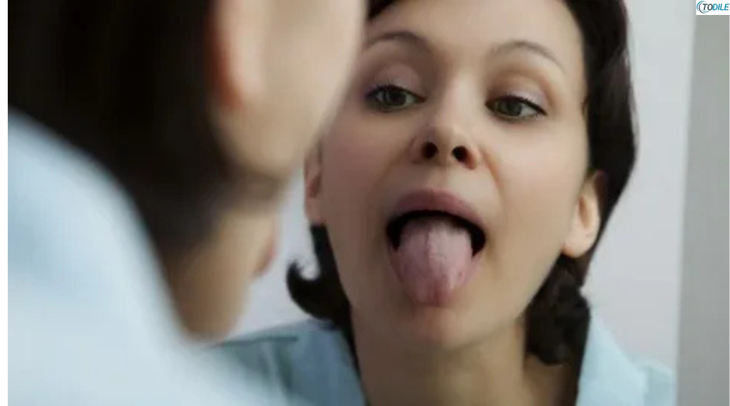 Read more about the article What Your Tongue Indicates About Your Health