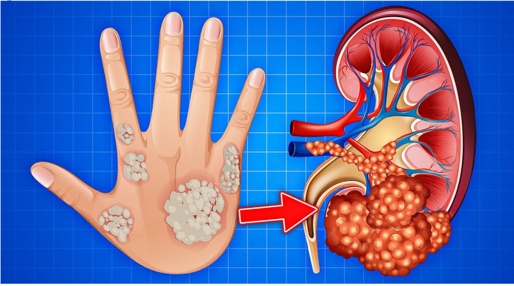Read more about the article 10 Signs You May Have Kidney Disease